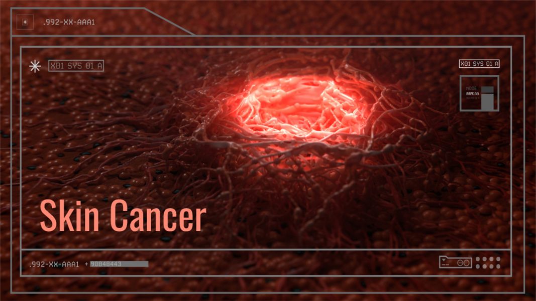 Red cells indicating skin cancer
